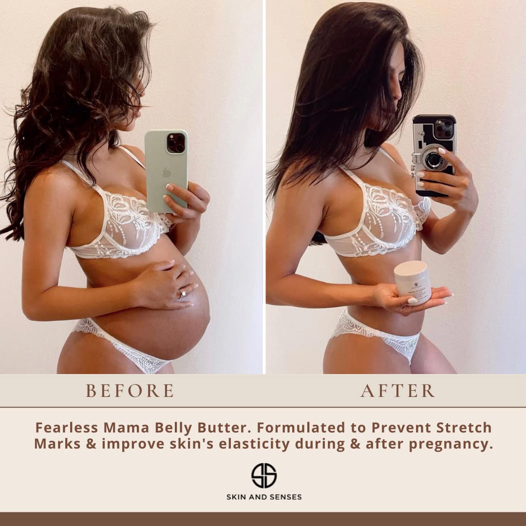 Fearless Mama Pregnancy Body Butter, Belly Butter for Stretch Marks, Deep Hydration for Dry, Tight, Itchy Skin During Pregnancy & Postpartum, with Shea Butter & Cocoa Butter, Unscented 5 oz